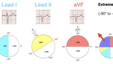 leads in real estate